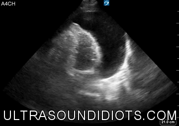 20ib9q.gif