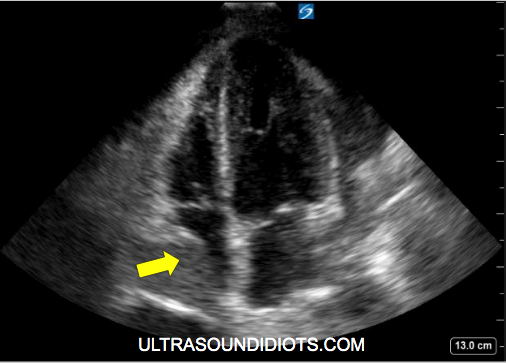 Figure 1b