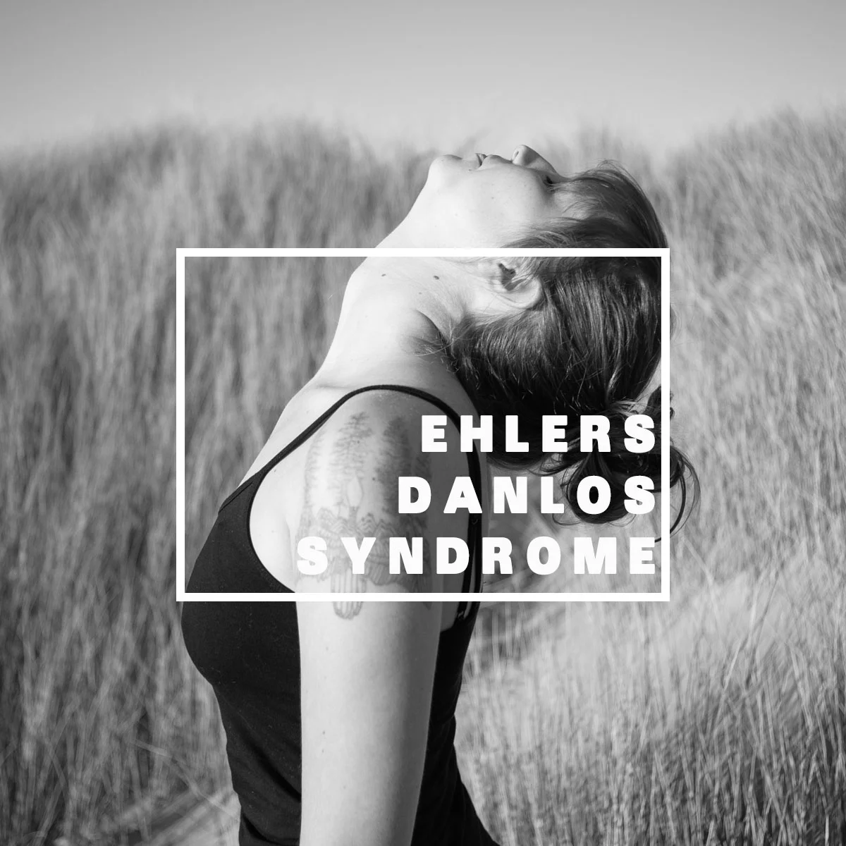Ehlers Danlos Syndrome 