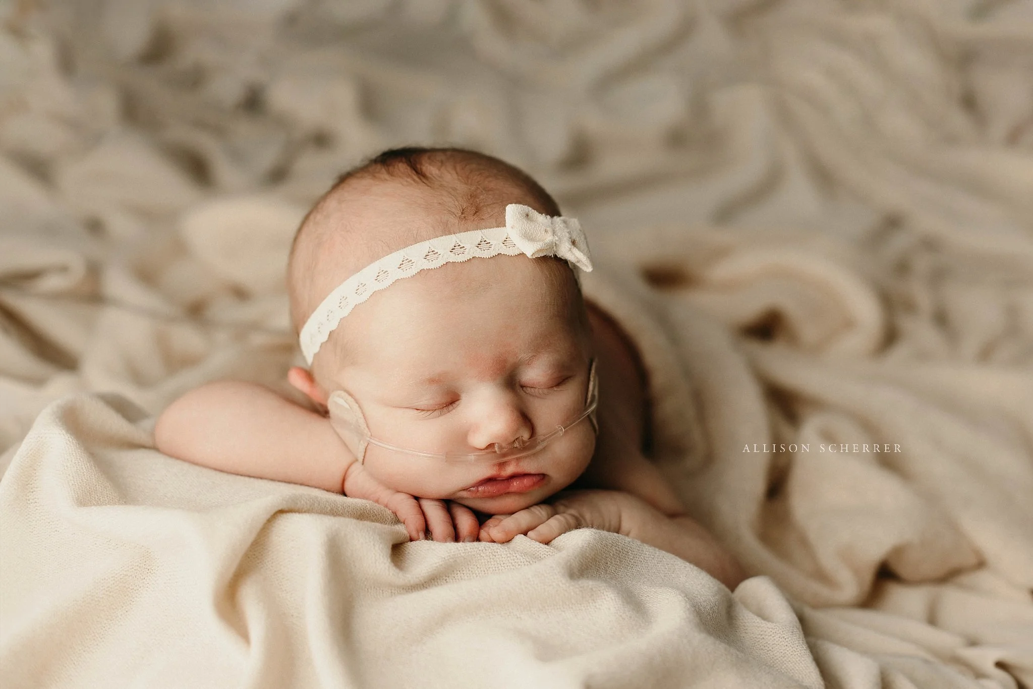 Colorado newborn photographer capturing baby with oxygen support