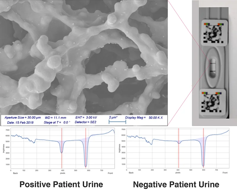 Absorbance of patient positive urine sample for ovarian cancer on left and negative patient urine sample on right.