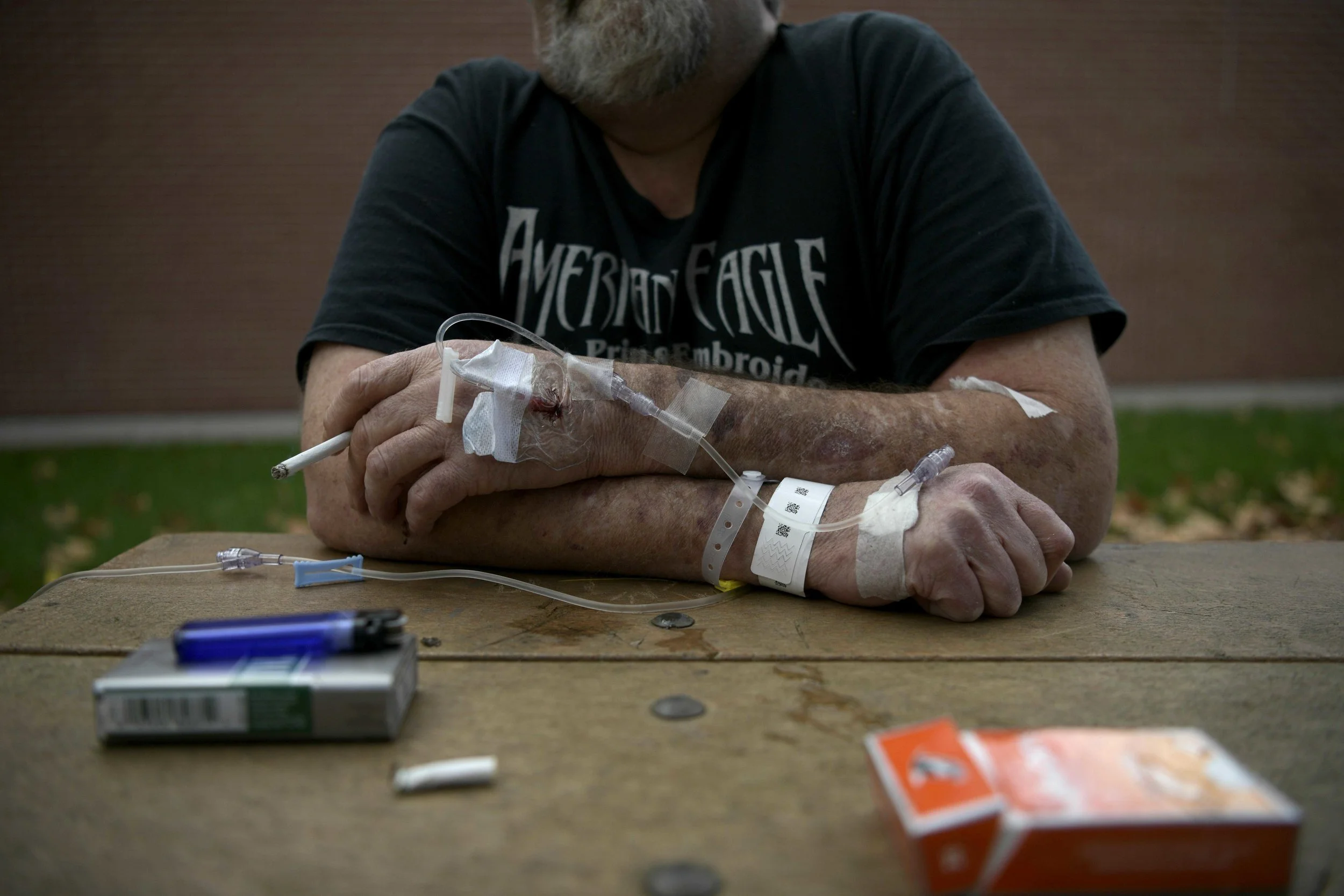 John Howard, 54, smokes a cigarette while attached to his IV in front of the St. Claire Hospital in Morehead, KY, on October 24, 2017. Howard has emphesyma but still finds himself smoking two packs a day. 