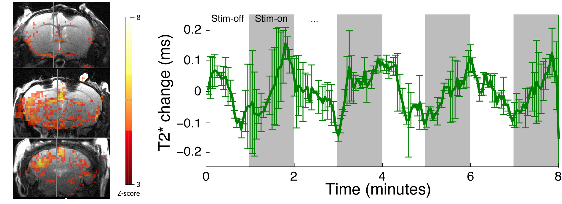 Functional MRI acquired during optogenetic stimulation of GABAergic neurons in the medial septum of the mouse brain. Left: BOLD fMRI activation maps; Right: Quantitative measurement of hippocampal T2* changes in response to stimulation.