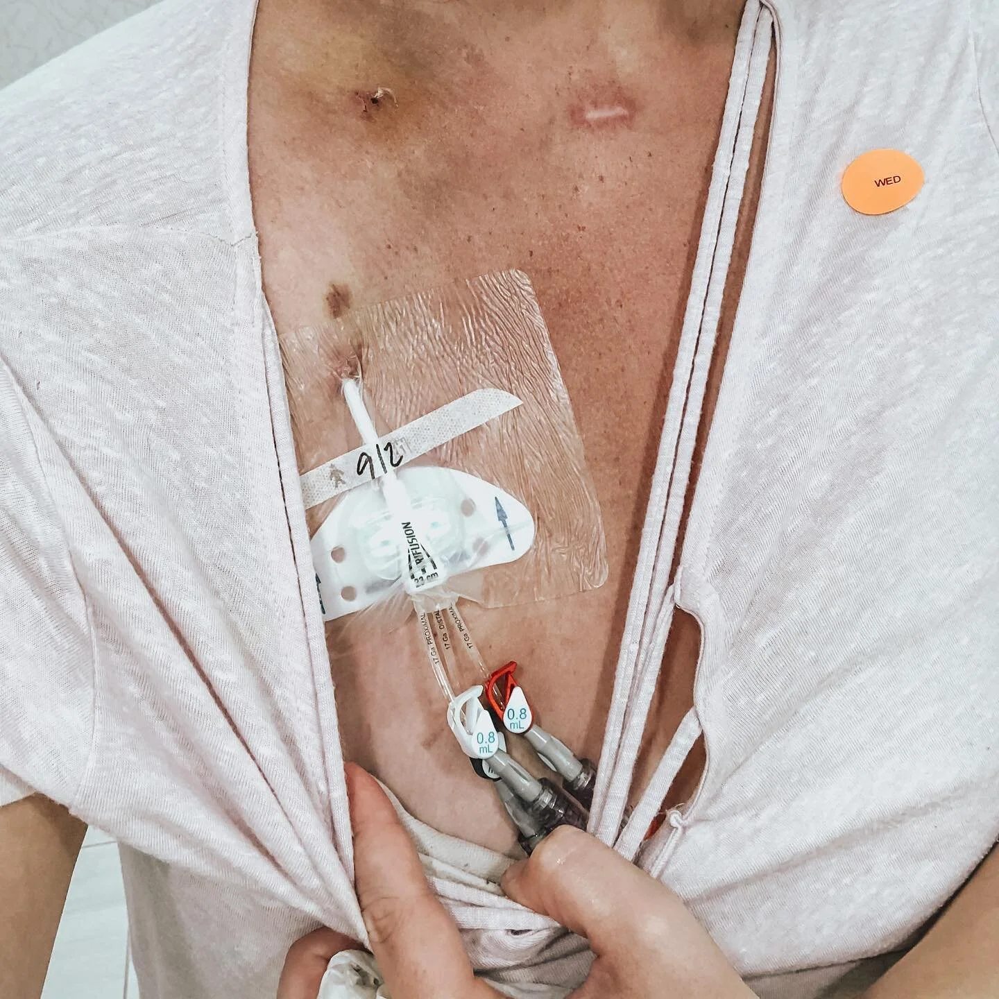 I&rsquo;ve been keeping another exciting piece of news hush hush for fear of it not coming true (why am I like this? 😂)... But tomorrow this bad boy is being removed 🙌🏻🎉

Maintaining this gadget was one of my biggest fears going into the SCT. And
