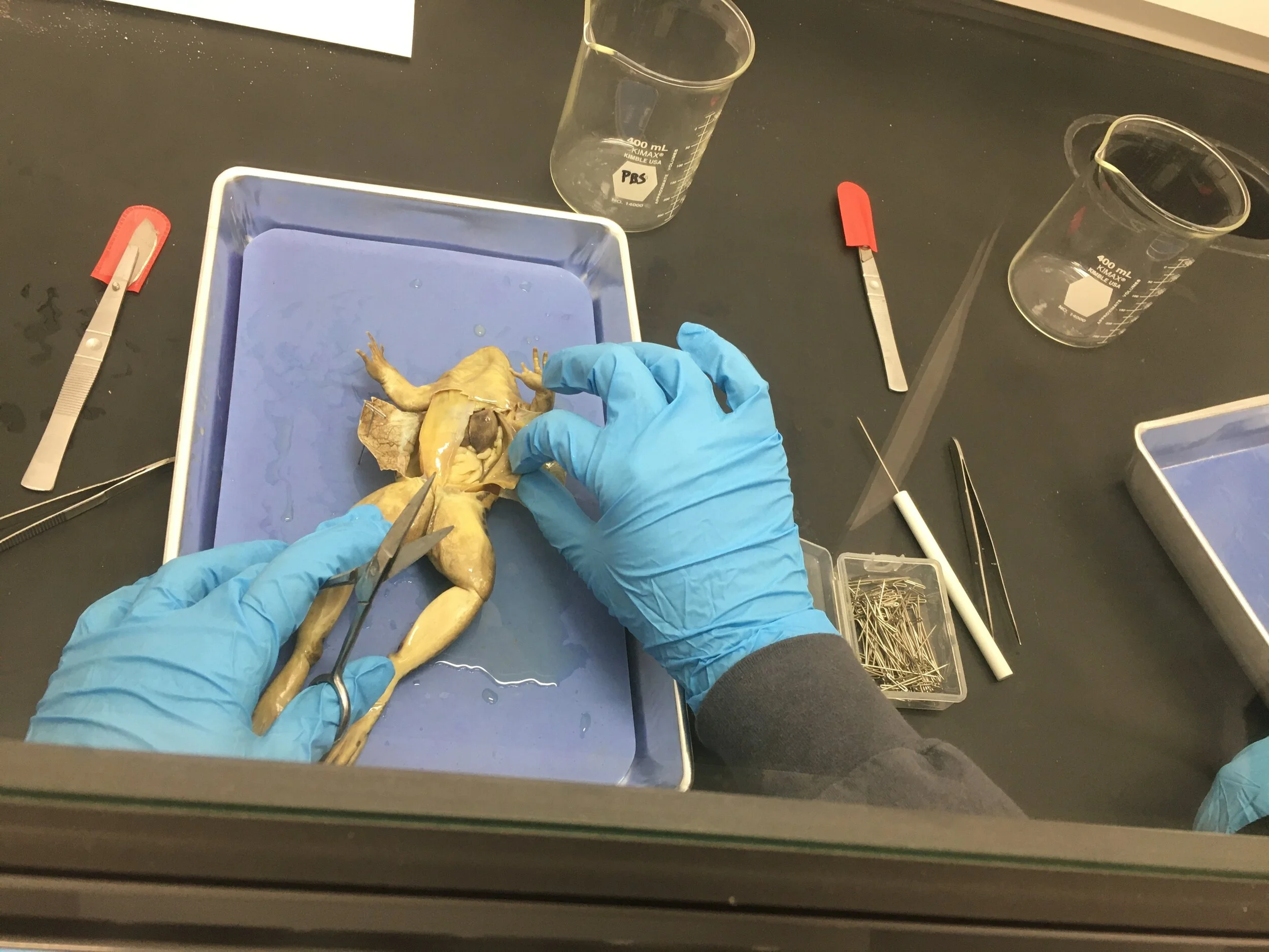 Adalei Brooks - Anatomy and Physiology