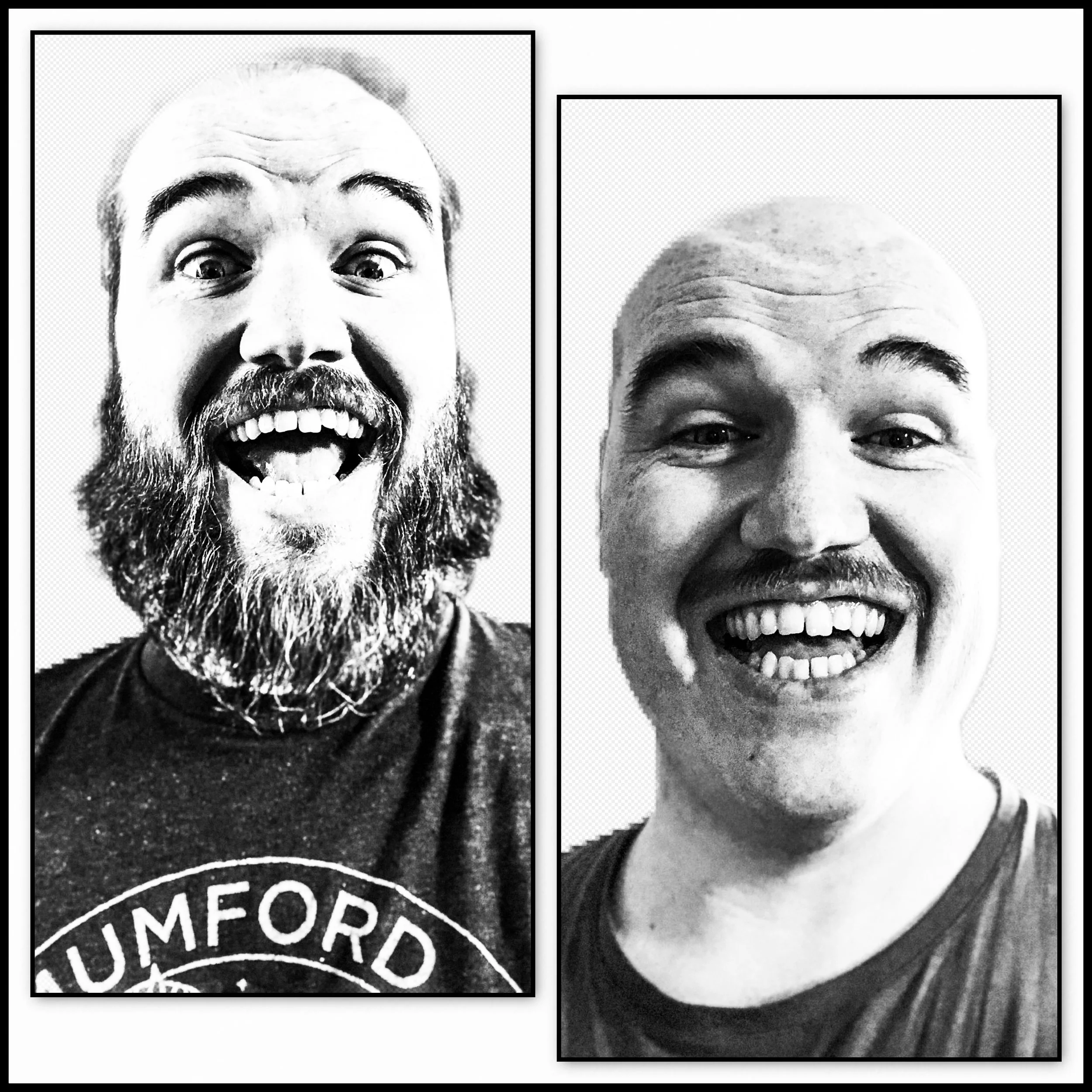 Cycle 2 Has Begun, Tumor Marker Update, & My Chin