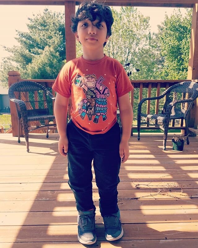 Look who is standing on his own! Arshaan has a long way to go and yesterday he worked hard in PT. His hips and his knees are really tight and after walking on bent up legs for so long, all his muscles are getting a real work out! 
Jansen's is like wo