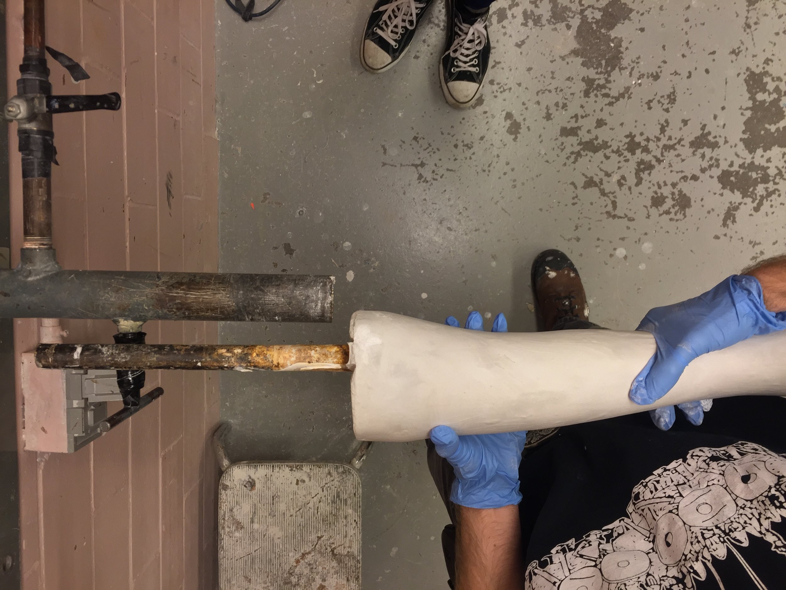 This is an ideal length for a mandrel. It extends about 7 inches proximal to the plaster.
