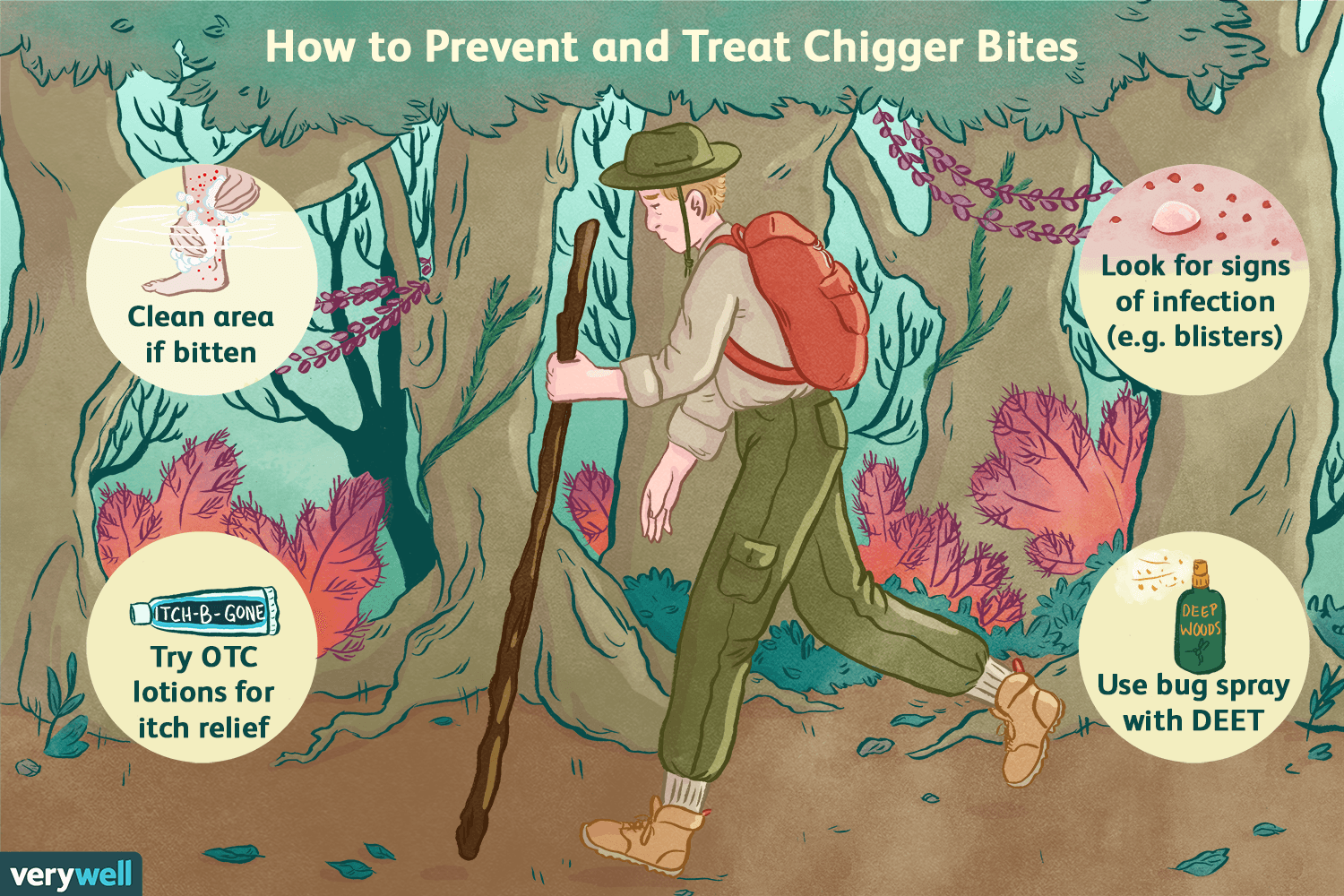 How to Prevent and Treat Chigger Bites