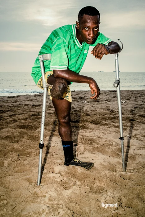 sierraleaoneb4ebloaamputee-76.jpg