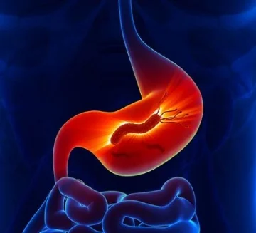 hpylori.jpg