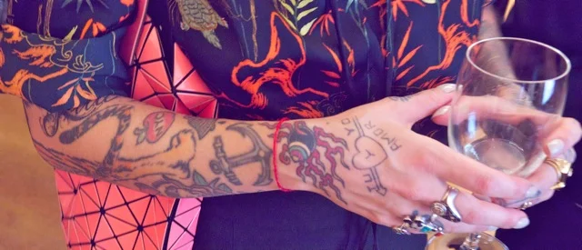Her arm
