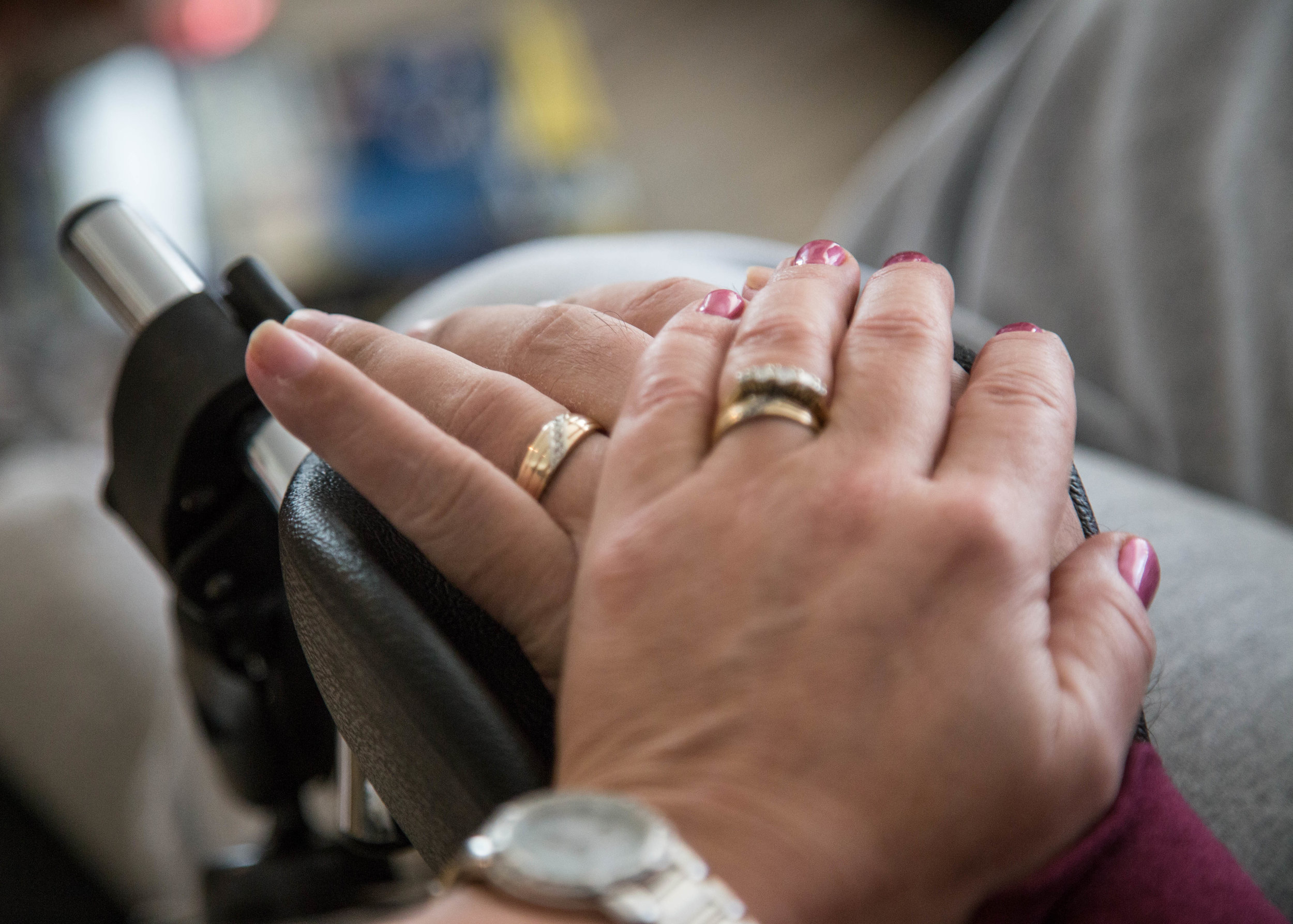 Living With Phantom Limbs