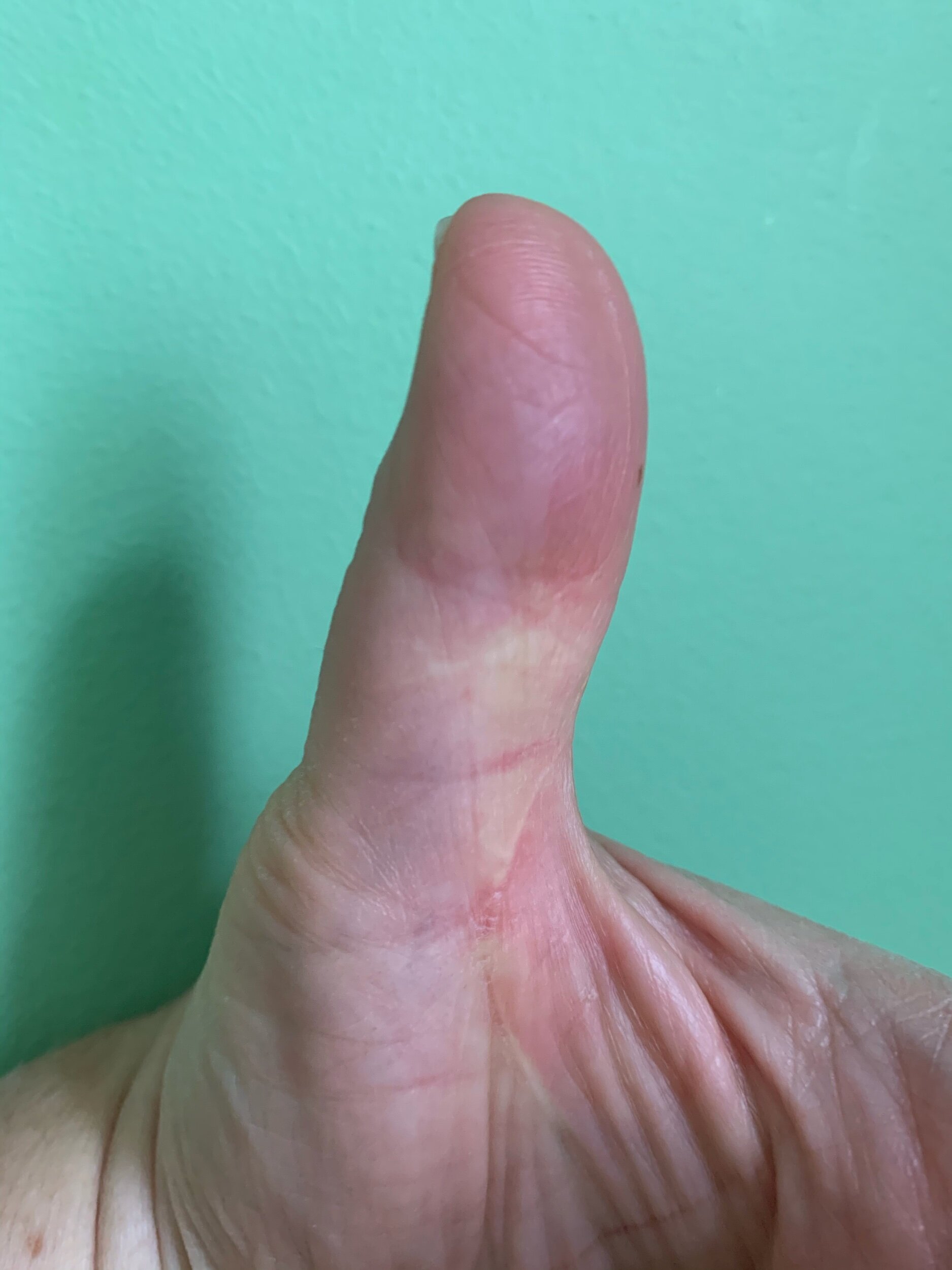 My thumb