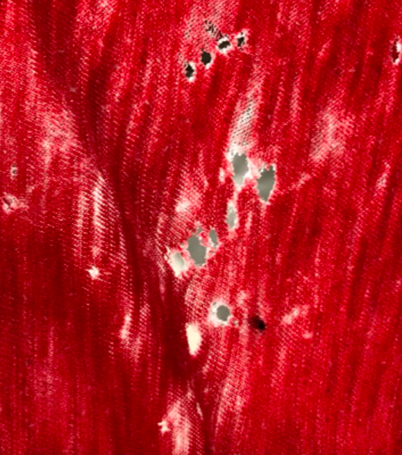 I'm Upset: Why Are There So Many Tiny Holes in My Shirts