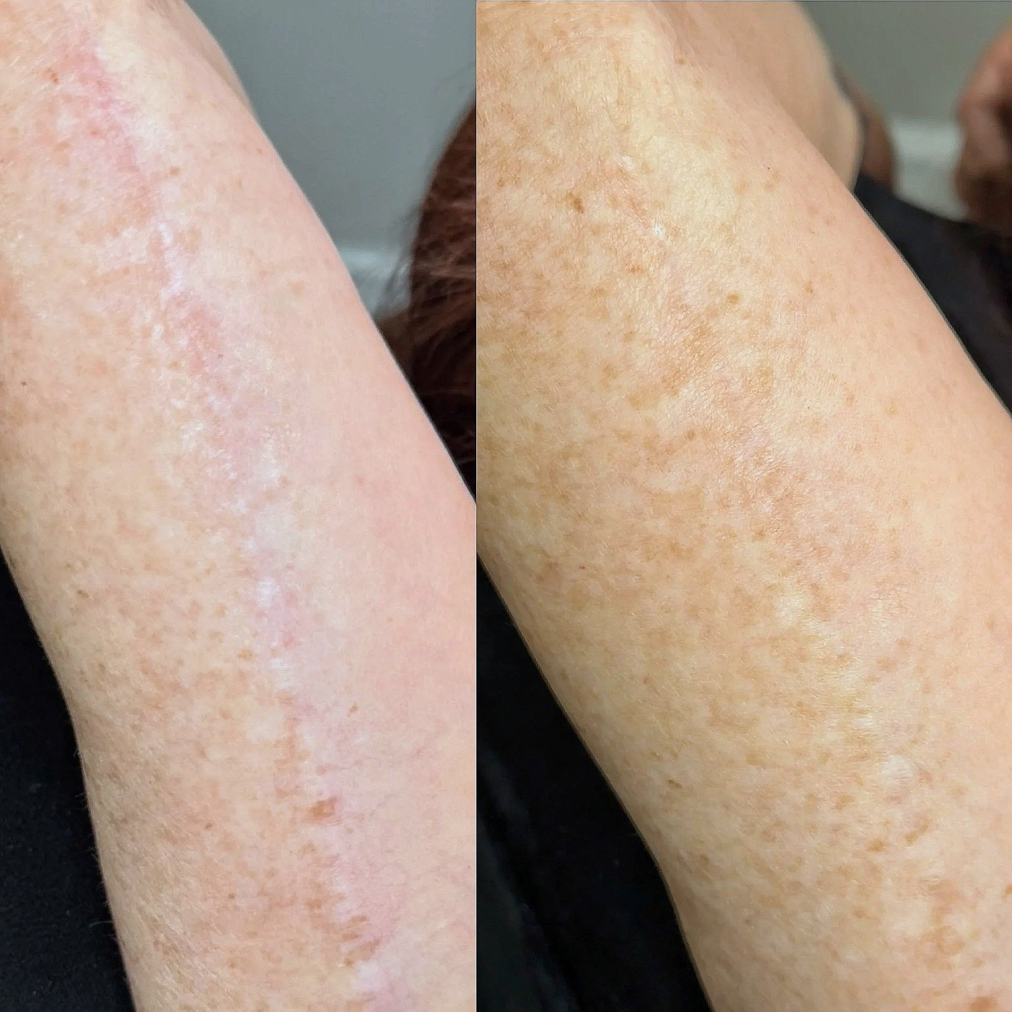 Facetune_29-07-2025-11-55-15.jpg