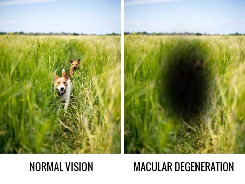 macular-degeneration.jpg