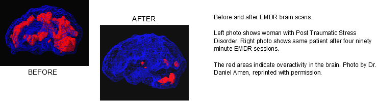 Trauma takes up brain power & space (as indicated by the highlighted red areas.)