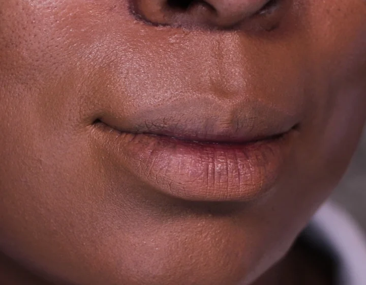 How to Get Rid of Laugh Lines for Smoother Skin - Dermalogica Nightly Lip Treatment Candy Coated Closets.jpg