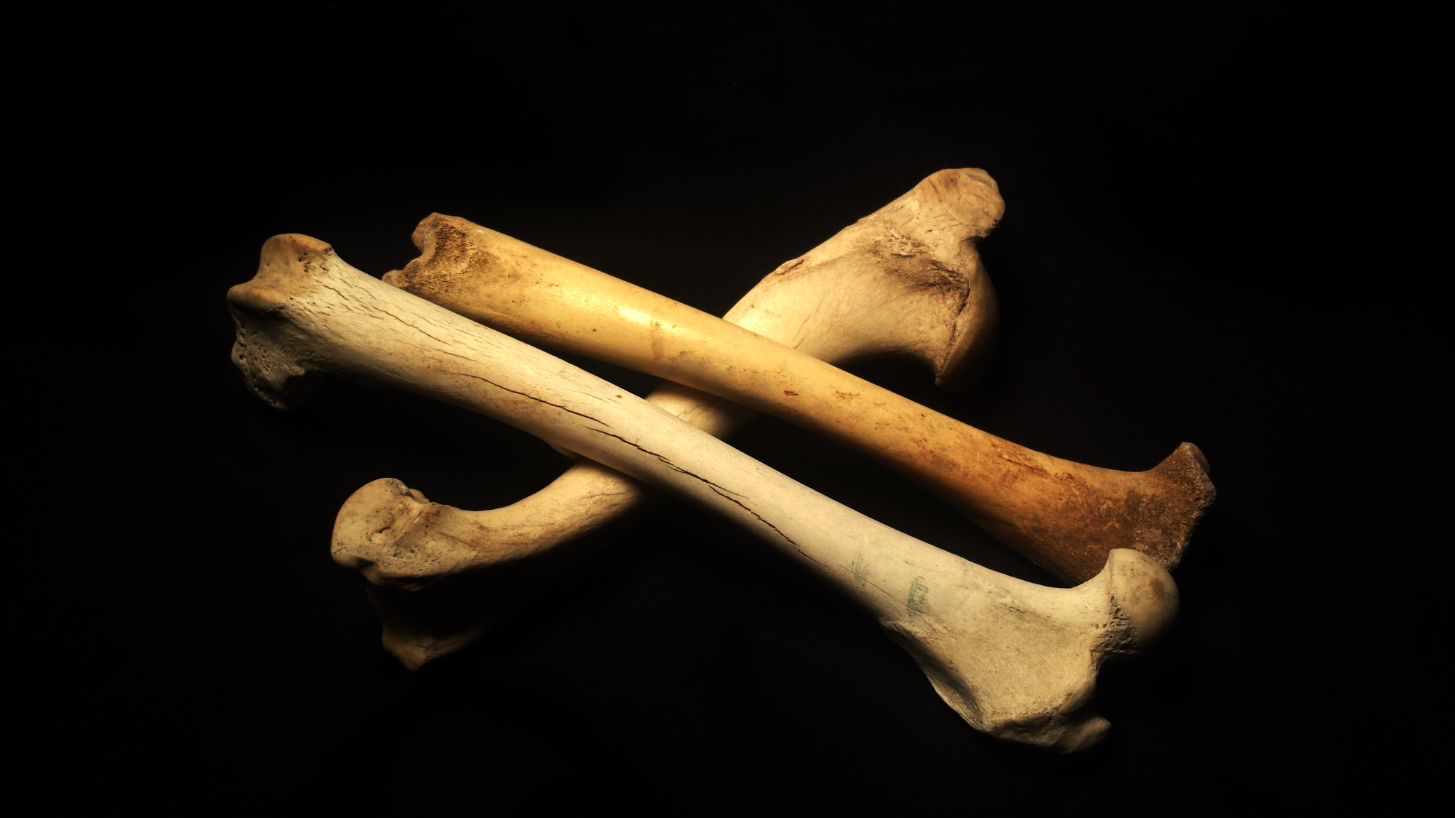  A human baby has around 100 more bones than an adult - why?