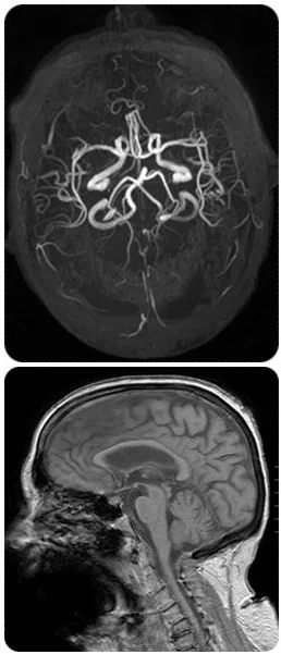MRI pics.jpg