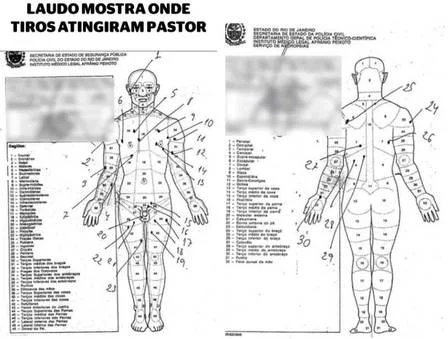 Graphic from Anderson’s autopsy indicating the location of bullet wounds.