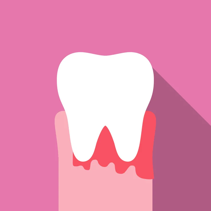  Bleeding Mouth 