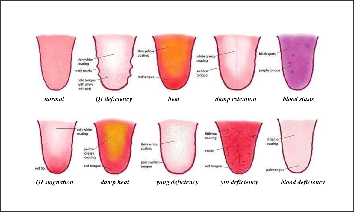 5 Things Your Tongue May be Trying to Tell You