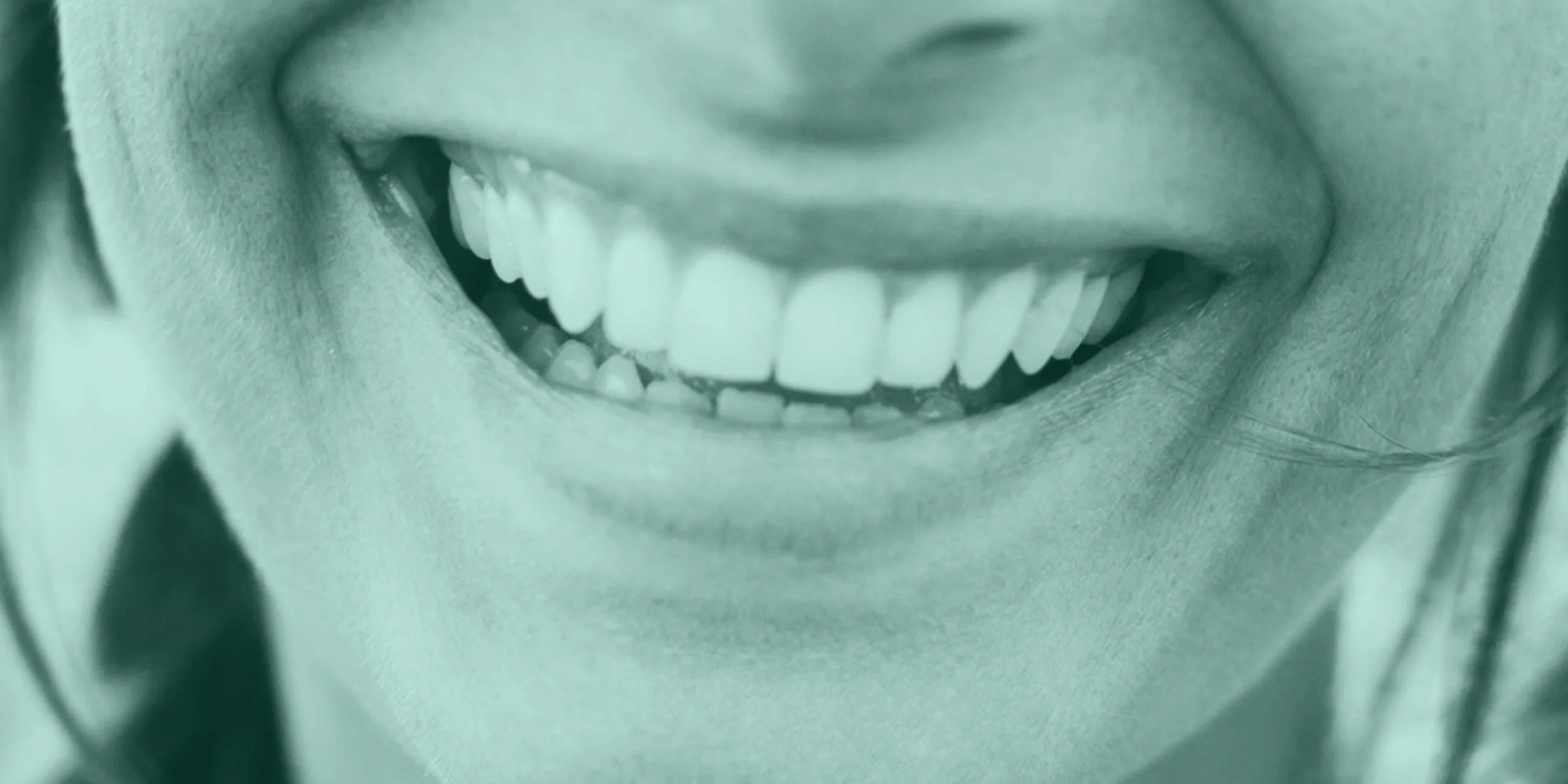 © Emergency Dentist Sydney Smile Gallery Before and After Teeth.jpg