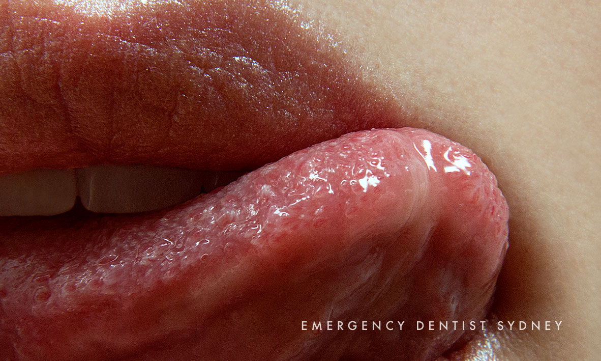©-Emergency-Denitst-Sydney.126.What-Is-Your-Tongue-Trying-to-Tell-You.1.jpg