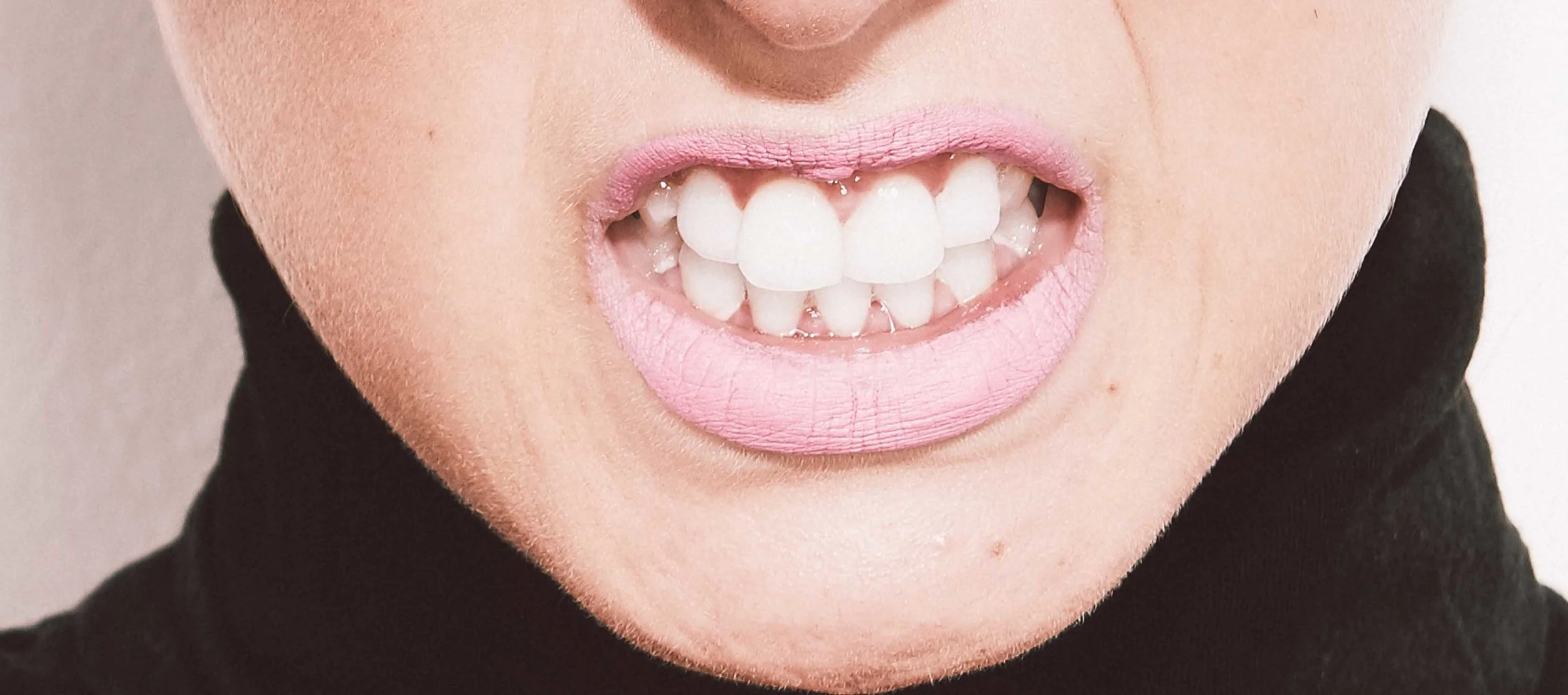 How Teeth Grinding Can Affect Your Oral Health