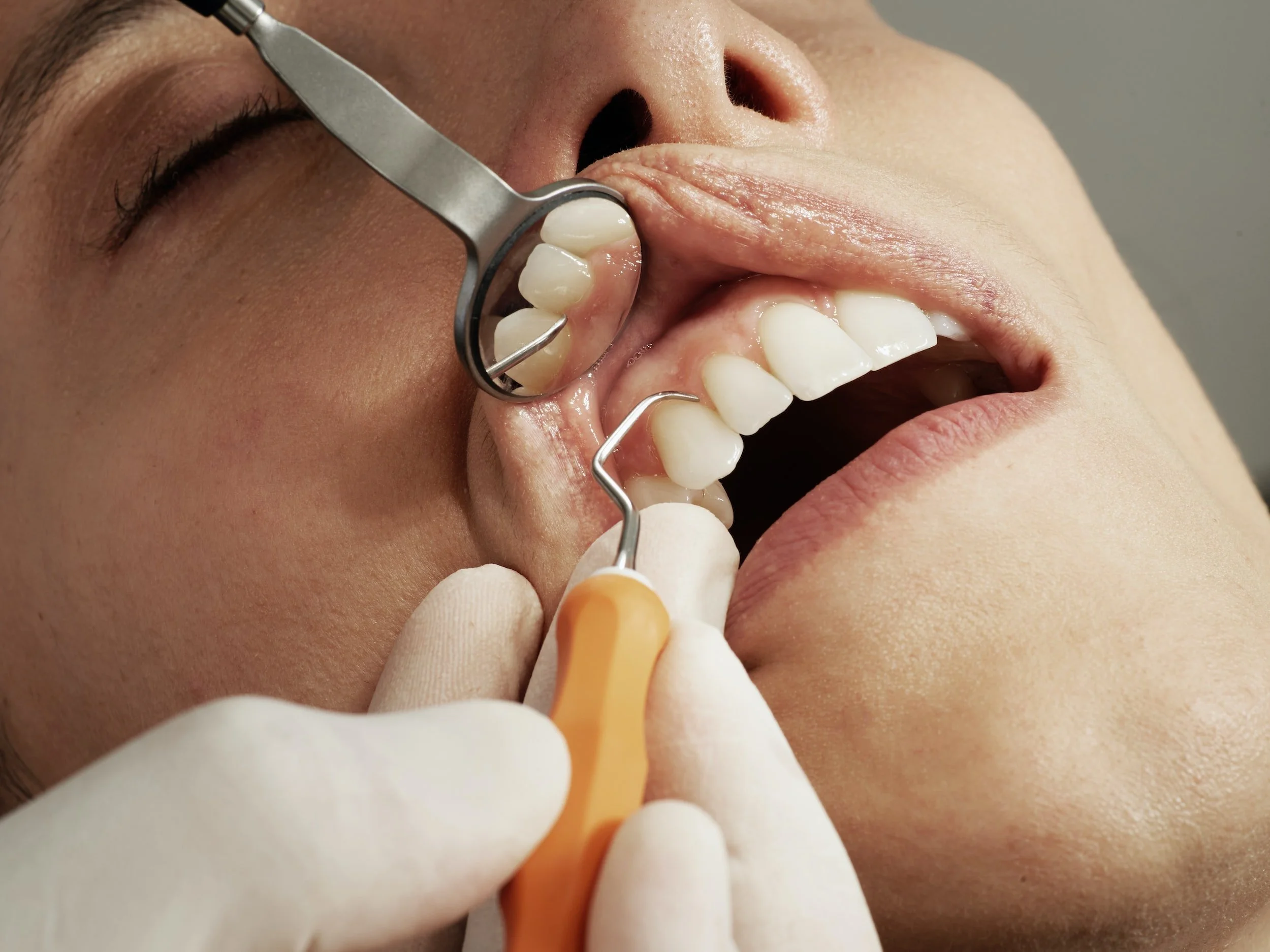 Does a Toothache Always Equal an Extraction?
