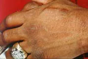 whitaker-hand2-.jpg