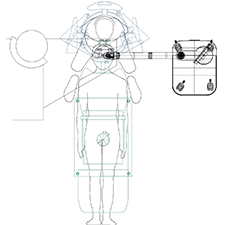 INTRALASE OPERATING ROOM ERGONOMICS Patient surgeon interface focusing on the eye.