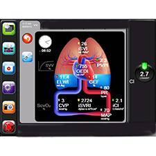 EDWARDS SAVING PATIENTS LIVES EV1000 Revolutionary bionic metaphor GUI for cardio-pulmonary monitoring