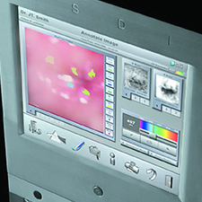STI DIGITAL BIOPSY GUI and the product design in aesthetic harmony.