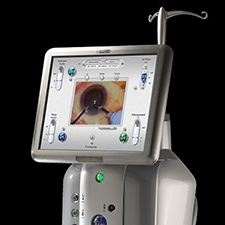 BAUSCH & LOMB STELLARIS PHACO SYSTEM Advancements in cataract surgery