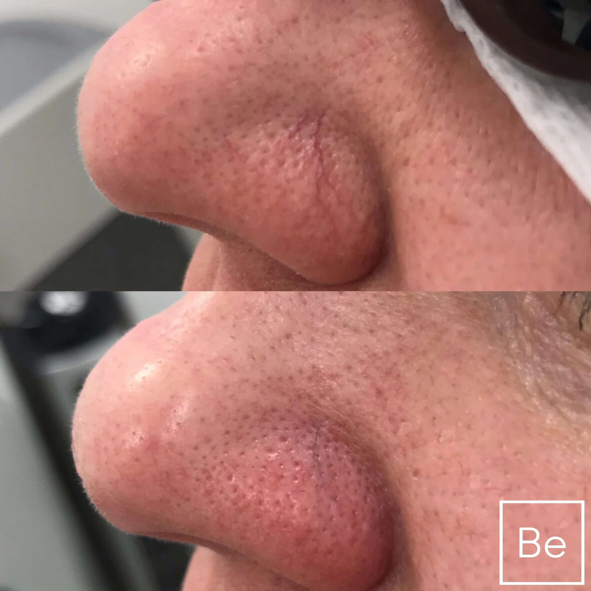 Skincare treatment at Bare Element Laser Salon