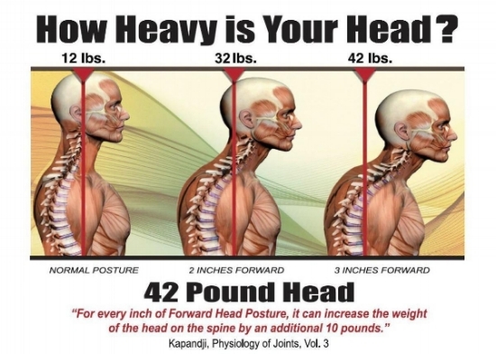 The Link Between Posture And Chronic Neck And Upper Back Pain Back Pain And Headache Specialist Burke Va Nova Headache Chiropractic Center