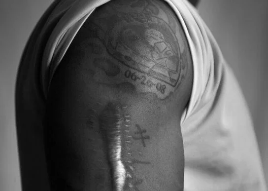 Does God care about my suffering? Jesus of the Scars