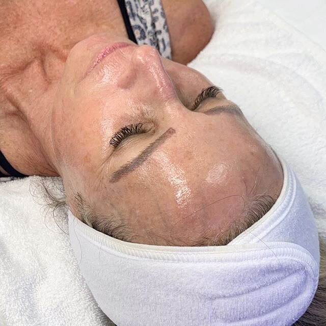 Helping my clients glow, one @hydrafacial at a time. 💧 .
.
.
.
. 
#hydrafacial #hydrafacialmd #thehydrafacial #hydrafacialist #thehydrafacialist #hydrafacialnation #3steps30minutes #thebestskinofyourlife #skin #facials #dermaplaning #isclinical #cel