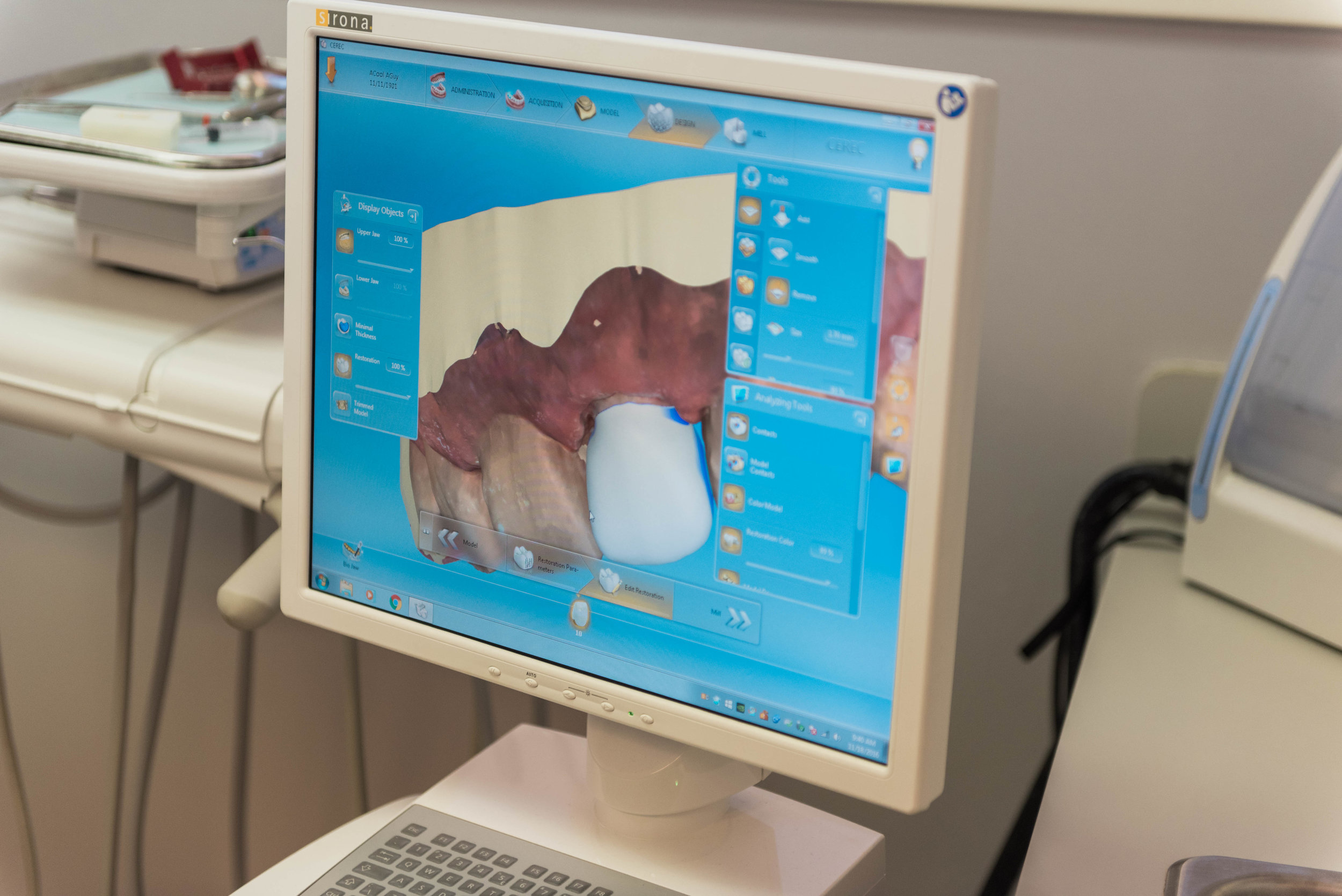 The CEREC machine takes the scanned images and uses them to custom design restorations made with high quality, biocompatible ceramic.