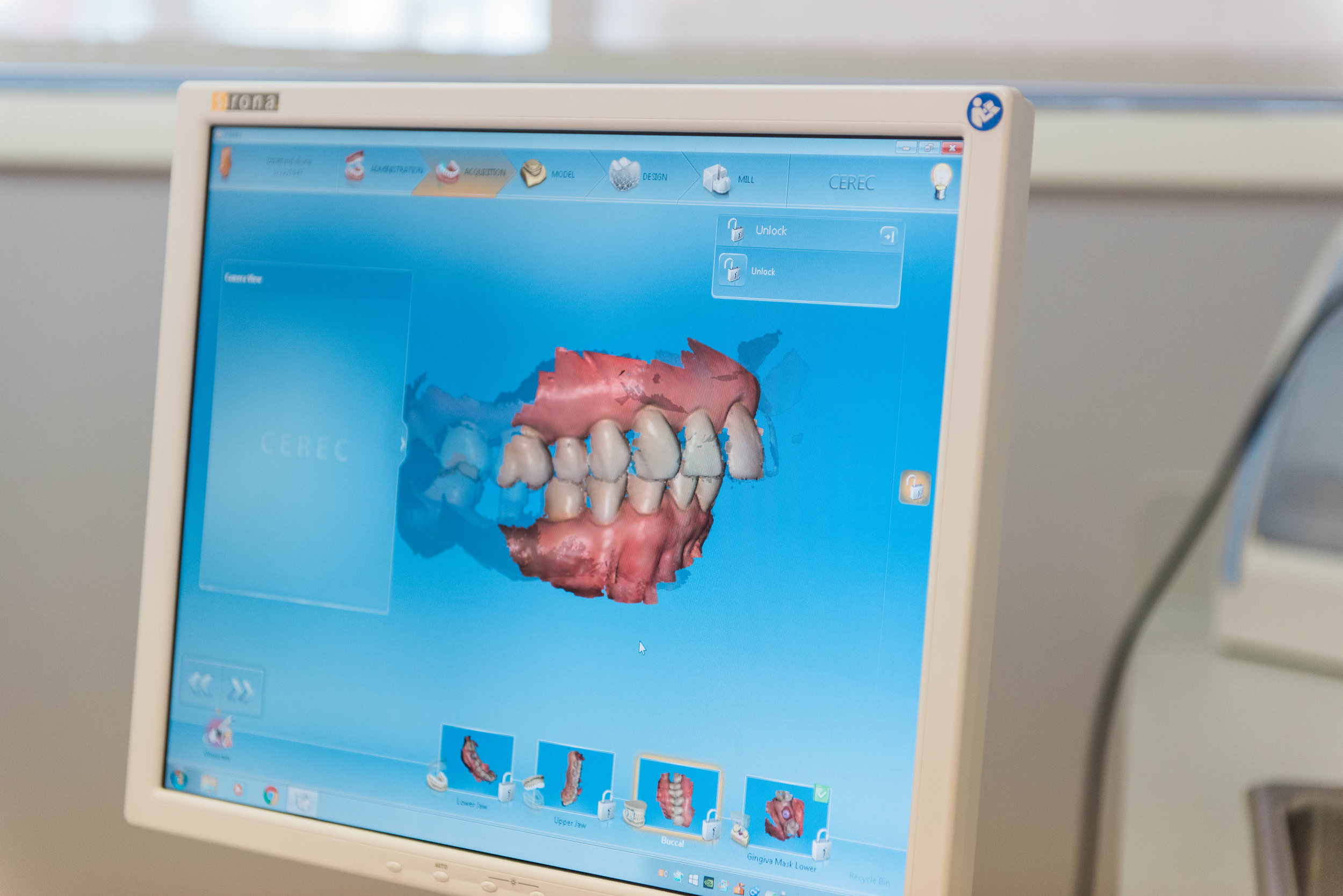 With the implant in place, function is returned to its most natural state. It is just like a whole new tooth, with no special care instructions and no drilling of neighboring teeth. To learn how dental implants can benefit your smile, make an appointment today.