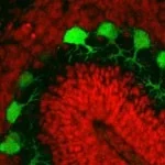Purkinje neurons in the developing cerebellum.