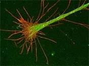 A growth cone guides the developing nerve cells and leads to the generation of over a 1000 trillion connections in the mammalian nervous system.