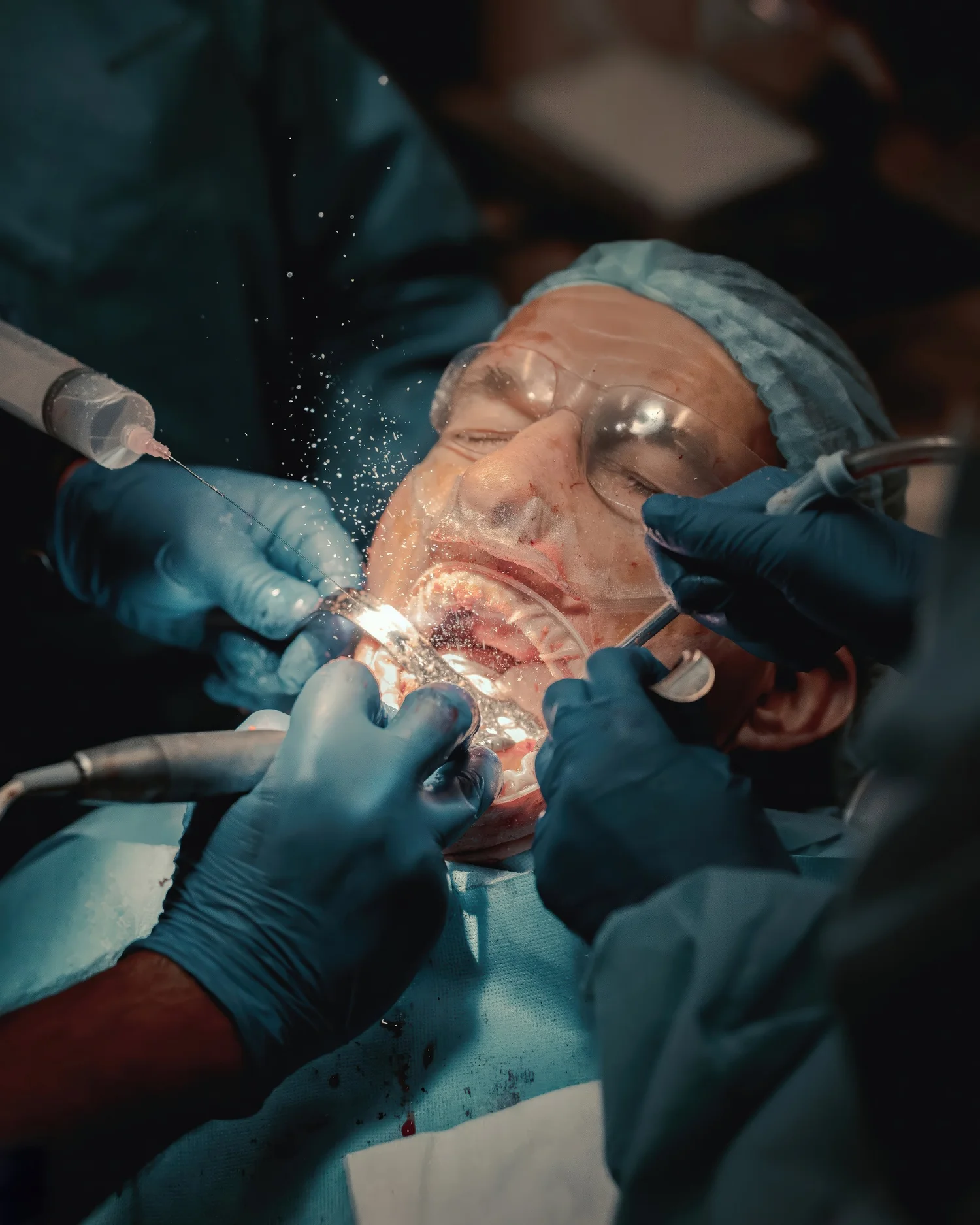 Active oral surgery procedure photographed for Pittsburgh dental and implant practice marketing