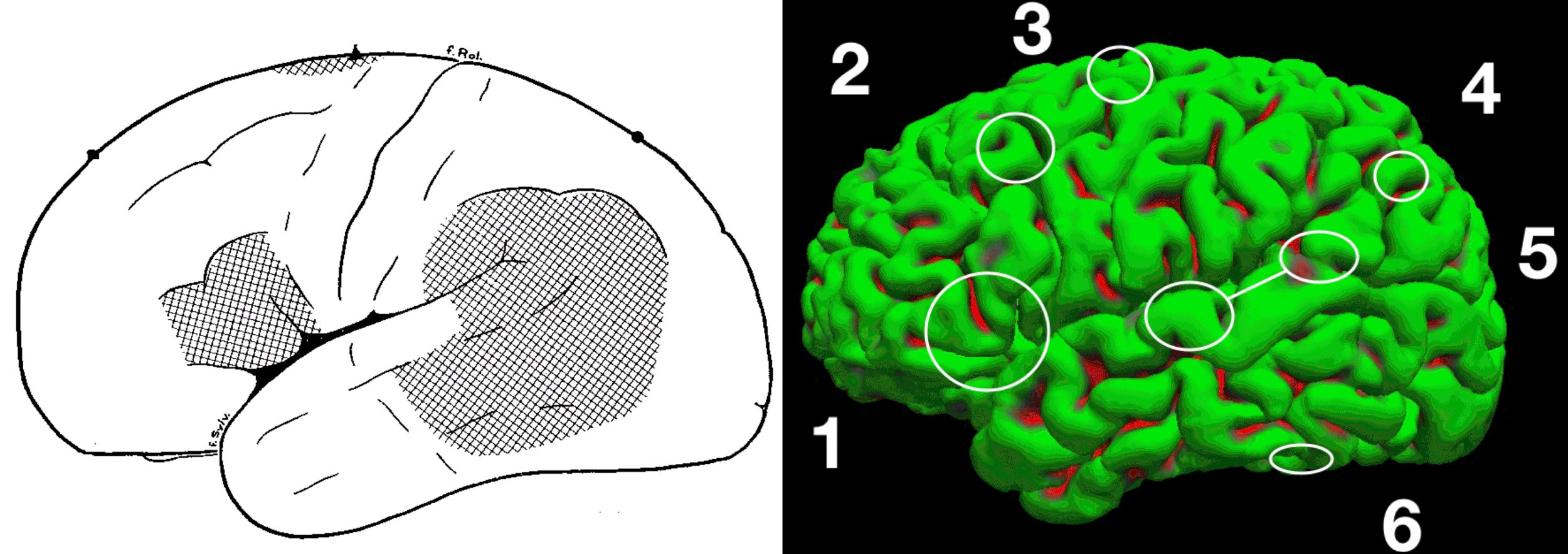 Language areas in the brain as per Wilder Penfield (left) and current research into language function (right).