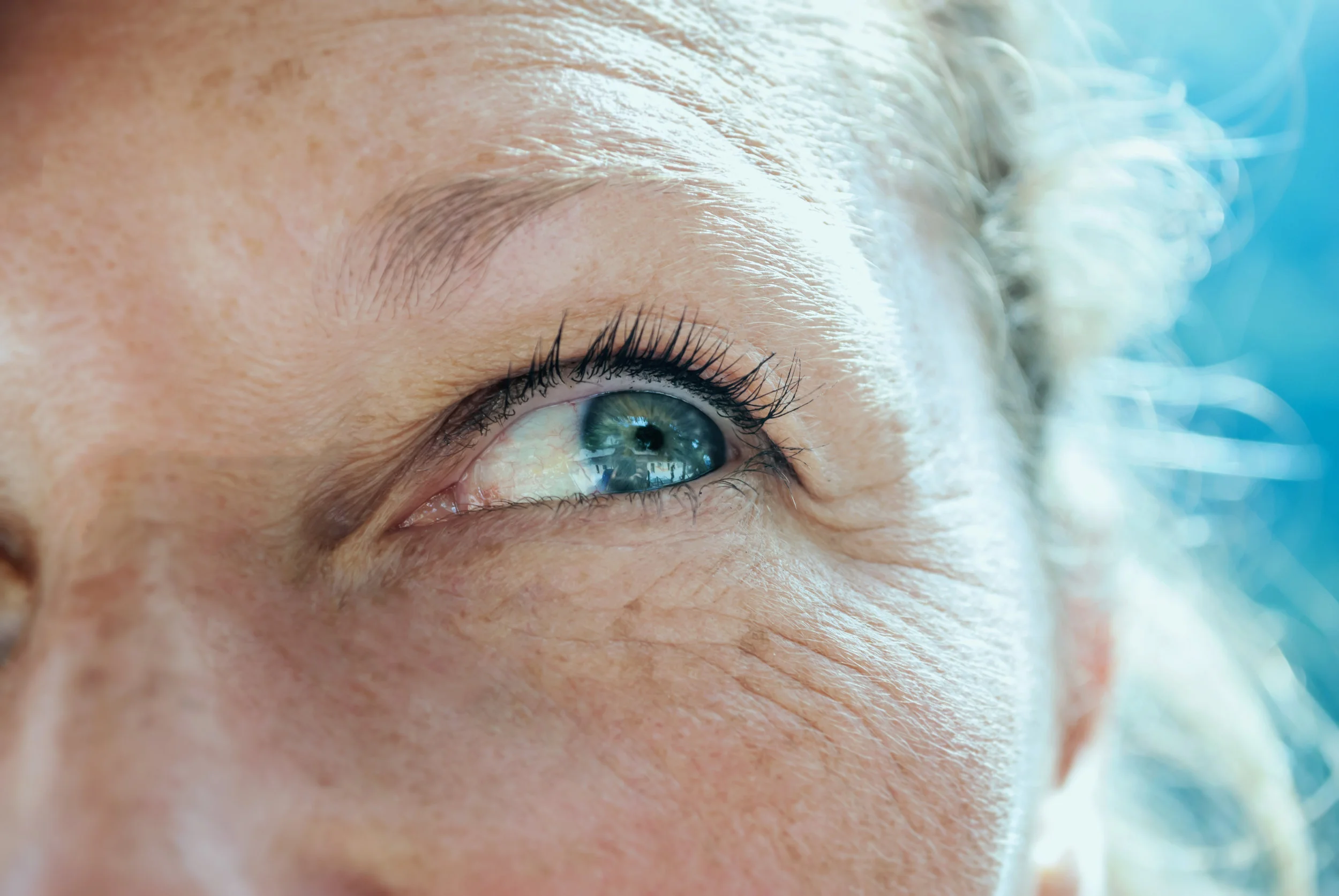 The difference between freckles and sun spots.
