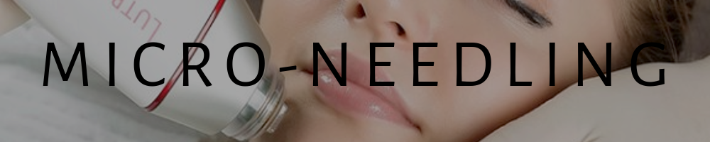 Microneedling in North London.png