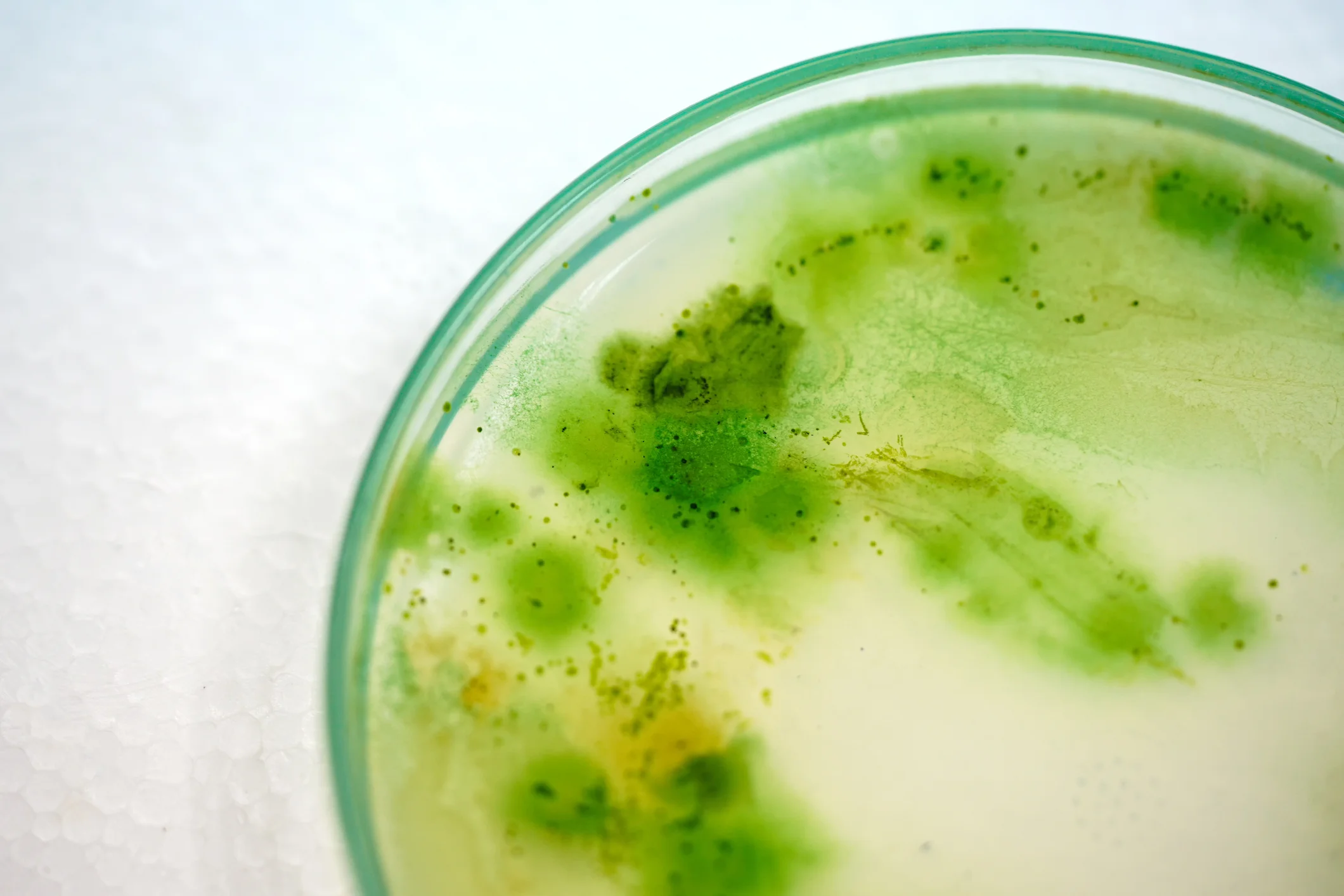 Cyanotoxin analysis of cyanobacteria (blue-green algae)